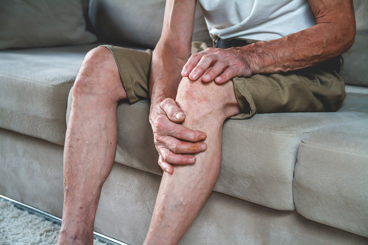 What Men Need to Know About Varicose Veins
