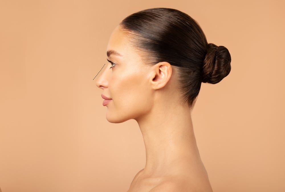 Side profile of woman's face with clear skin after face vein treatment in Tampa, FL
