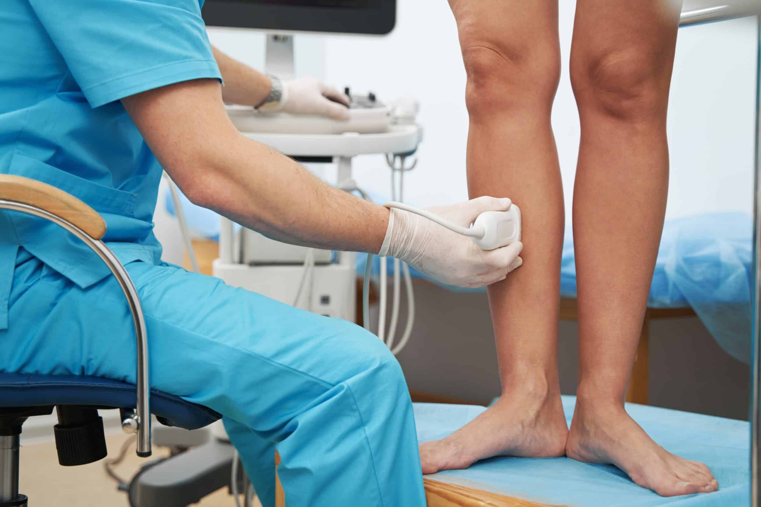 Close up of woman's legs being evaluated for varicose veins after pregnancy in Tampa, FL