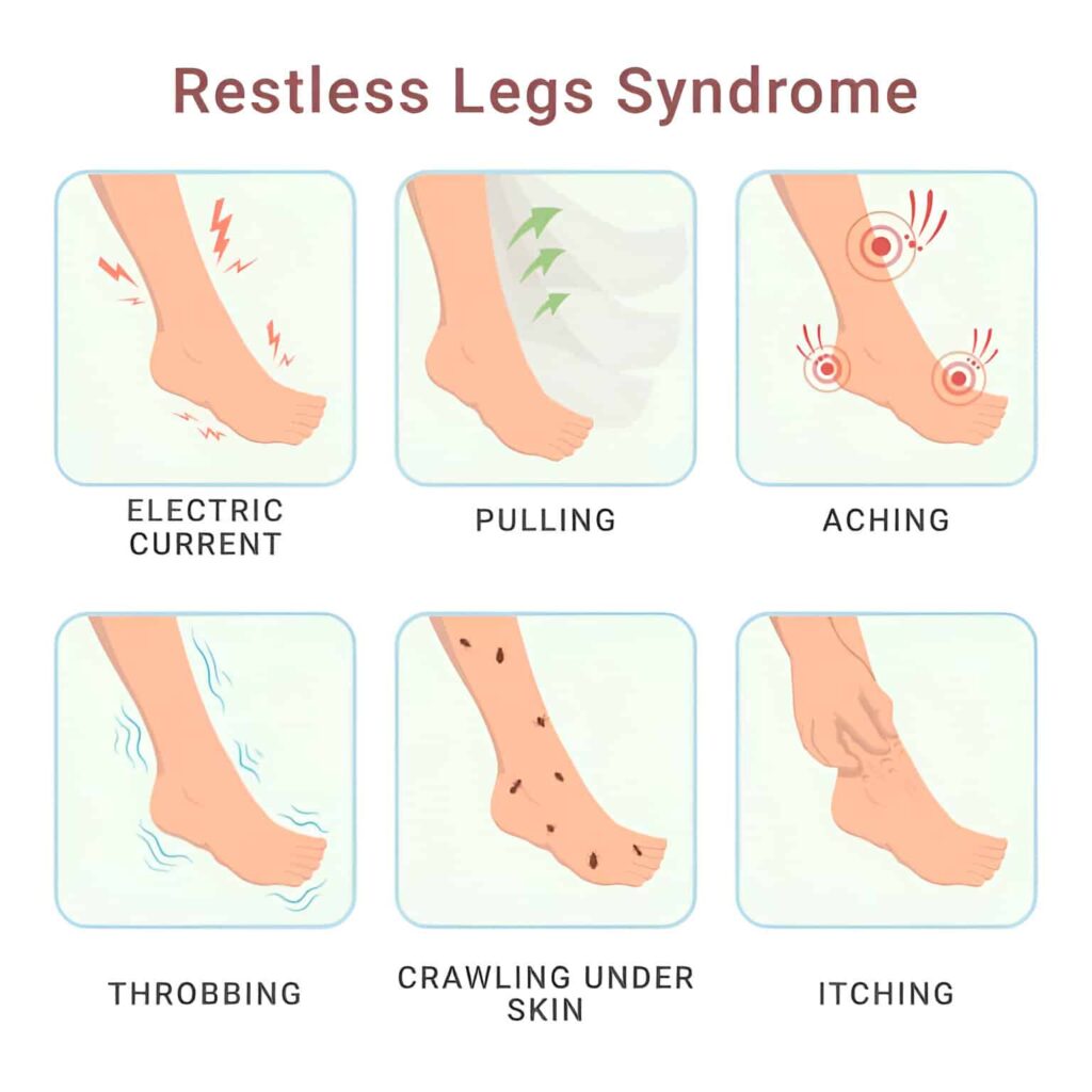 Restless Legs Syndrome Restless Leg Syndrome (RLS) Treatment Tampa FL