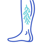 Leg Varicose Vein Treatment Tampa