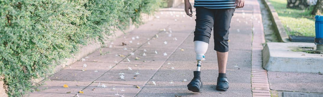 Can Leg Ulcers Lead to Amputation? Vein911