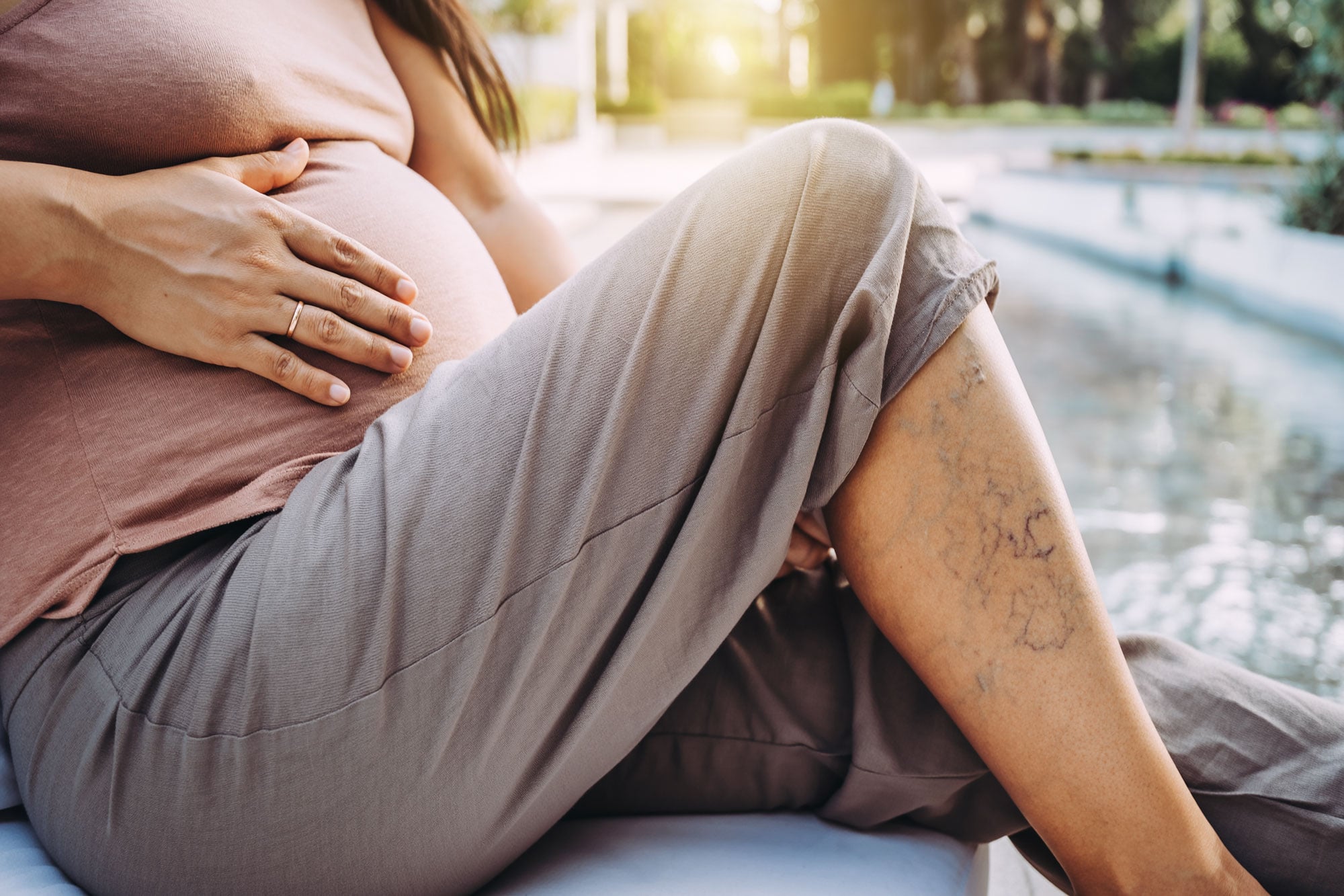 Pregnant woman seated with visible veins on her lower leg