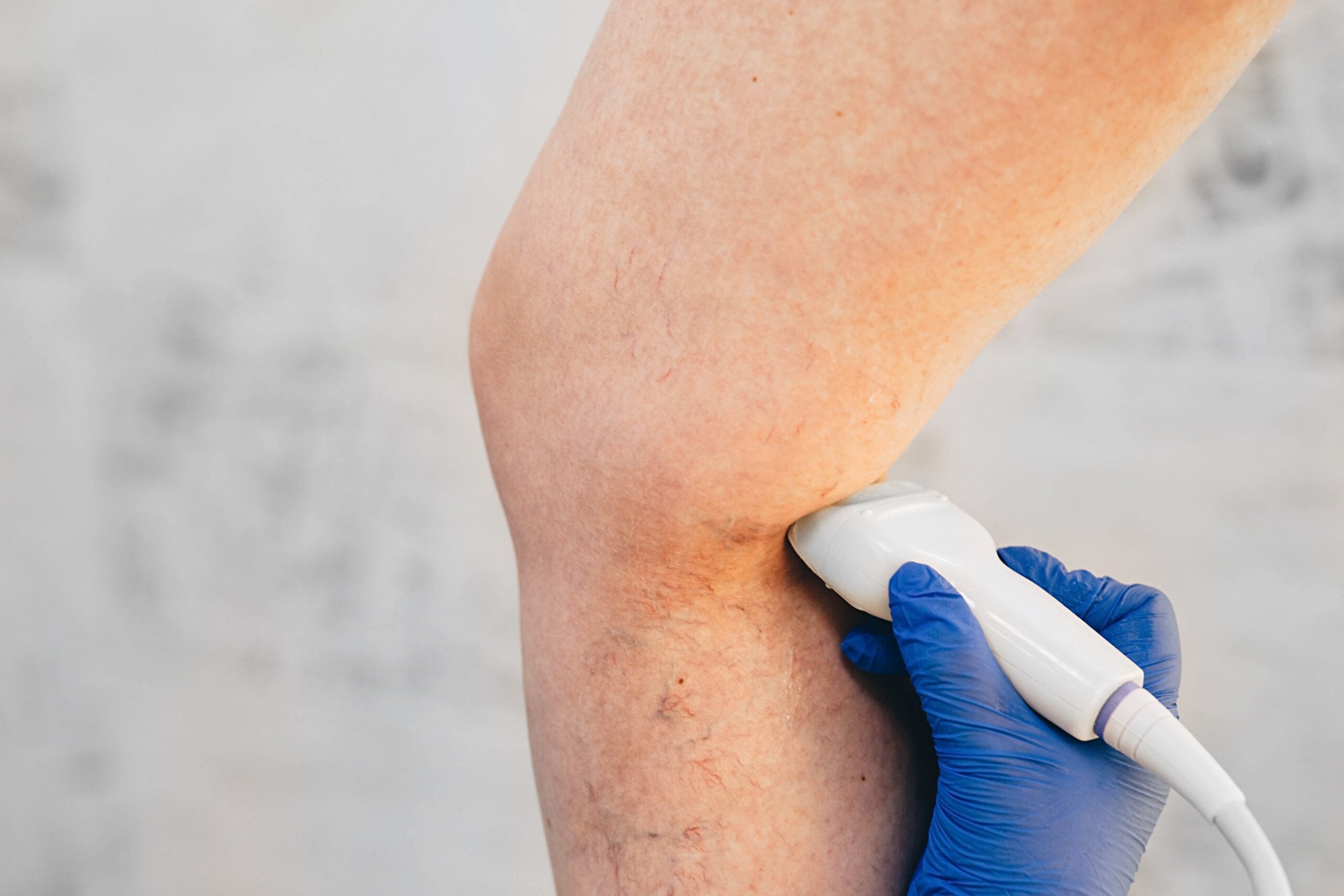Ultrasound examination of a patient’s leg